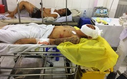 Cặp đôi nam nữ đi trộm cắp, đâm người truy đuổi trọng thương