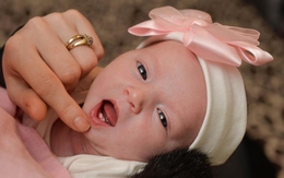 Bé sơ sinh chào đời đã có hai răng cửa