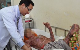 Nổ biến áp ở Sài Gòn, 2 nhân viên điện lực bỏng nặng