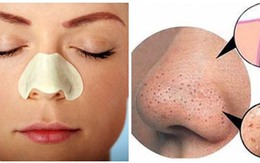 Đây là cách rẻ tiền và đơn giản nhất tôi dùng để “hạ gục” mụn đầu đen, bạn cũng thử đi