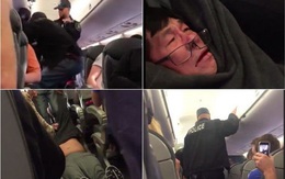 United Airlines hứa hoàn trả tiền vé sau vụ lôi hành khách khỏi máy bay