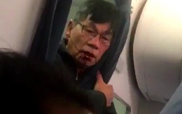David Dao bắt đầu hành động pháp lý với United Airlines