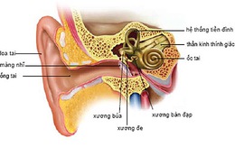 Dùng giấy quyến vá màng nhĩ