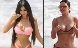 Cô gái Brazil chi 180 nghìn đôla để có vòng ba to hơn Kim Kardashian