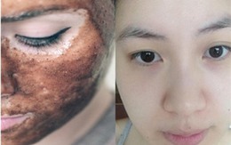 Da trắng bóc, sạch tế bào chết chỉ với 1 muỗng đường nâu