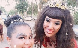 Cô gái Thái Lan có 'hàm răng phù thủy' lột xác sau khi dao kéo