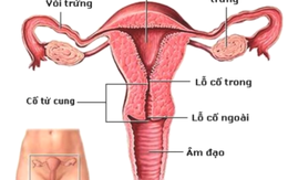 8 dấu hiệu lạ cảnh báo bạn bị ung thư cổ tử cung