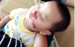 Thông tin bất ngờ vụ cha chém rách mặt con trai 2 tuổi ở Tuyên Quang