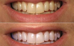 Lọ nước rẻ bèo này có tác dụng làm đẹp tới không tưởng!