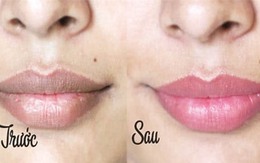 Môi thâm bẩm sinh cũng căng mọng, hồng hào nhờ đắp 1 lát củ dền