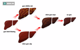 Chuyên gia: Muốn phòng ung thư gan, thay vì "3 sớm" phải tiến hành "6 sớm" mới đủ an toàn