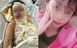 Hàn gắn tình cảm bất thành, thuê người tạt axit 2 thiếu nữ