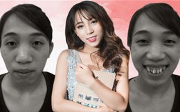 Những ca thẩm mỹ làm thay đổi cả số phận gây bão năm 2017