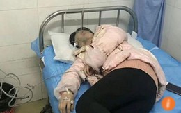 Cô giáo bị phụ huynh đánh nhập viện vì mắng học sinh điểm thấp