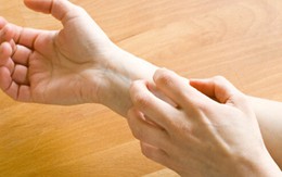 Bệnh Eczema: Giải pháp mới giúp phòng ngừa và điều trị toàn diện