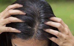 Đừng xem nhẹ, tóc bạc sớm cũng là dấu hiệu cảnh báo hàng loạt vấn đề sức khỏe