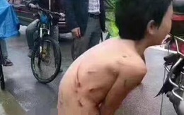 Bé trai bị bố đánh đập, bắt cởi quần áo chạy theo xe máy dưới mưa