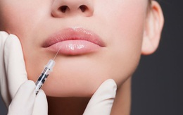 Bác sĩ cảnh báo về tác dụng phụ đáng sợ của việc bơm môi, trước khi làm đẹp chị em cần phải suy nghĩ kỹ
