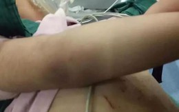 Bé gái 3 tuổi nhập viện với thương tích đầy mình và tội ác của người mẹ kế khiến dư luận phẫn nộ