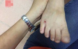 Hà Nội: Cô giáo mầm non đánh con riêng của chồng phải nhập viện