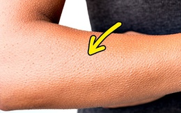 Những hiện tượng quen thuộc ai cũng nhìn thấy nhưng lại "lười hỏi Google" xem tại sao