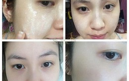Dùng thế nào để mặt nạ cám gạo làm da trắng hồng, hết sạch thâm nám