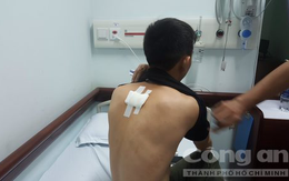 Bị đâm trọng thương, nam bảo vệ trẻ vẫn dũng cảm bắt cướp