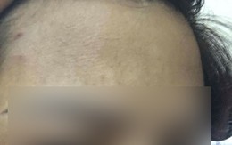 Hà Nội: Hai người phụ nữ choảng nhau ngay tại ngân hàng vì số thứ tự xếp hàng