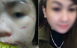 Mẹ kế cháu bé 10 tuổi bị bạo hành: "Tôi nghĩ tôi đánh để bố cháu không đánh cháu"