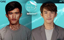 Con trai đẹp như tài tử sau thẩm mỹ khiến mẹ không thể nhận ra