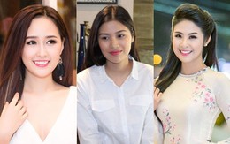 Á khôi tước ngôi và chuyện Hoa hậu làm răng khi vừa đăng quang