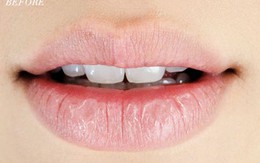 Môi bong tróc như da rắn chỉ cần 1 phút “lăn lăn” là mịn màng, hồng hào như môi em bé ngay