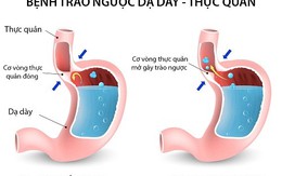 Cách ngăn chặn tình trạng trào ngược axit dạ dày