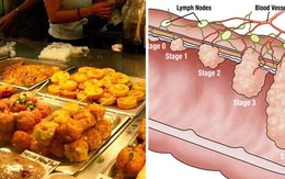 5 nhóm người dễ mắc ung thư đại trực tràng, hy vọng không có bạn trong đó