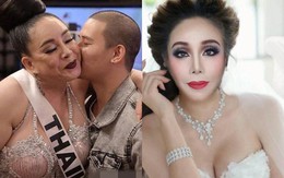 Sự thật về gương mặt sưng vù của nữ đại gia U60 kén chồng trẻ có thể quan hệ 28 lần/ngày