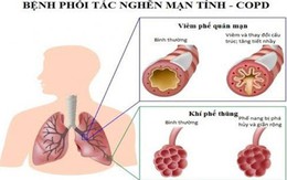 Chế độ ăn khoa học cho người bị bệnh phổi tắc nghẽn mãn tính