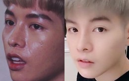 Sau 1 năm thẩm mỹ, nhan sắc của Đức Phúc bây giờ ra sao?