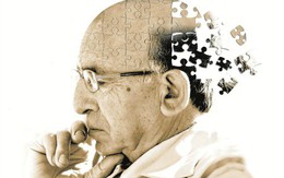 Có thuốc chữa khỏi bệnh mất trí nhớ?