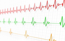 Nhịp tim chậm có nguy hiểm?