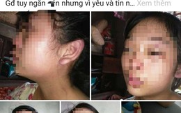 Vụ mẹ trẻ 16 tuổi cầu cứu vì chồng bạo hành: Người chồng nói mình bị 'oan'?
