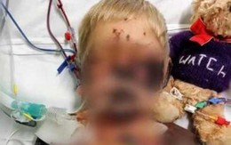 Cậu bé 4 tuổi tưởng bị cảm cúm, không ngờ mắc bệnh nguy hiểm, chết sau 13 ngày nằm viện