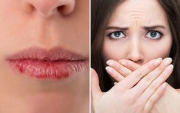 Ai cũng nghĩ môi khô nứt nẻ phải tẩy da chết ngay, nhưng bác sĩ da liễu lại khuyên nên làm điều này
