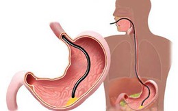 Khi 20, 30, 40, 50 và 60 tuổi, bạn cần làm những xét nghiệm sức khỏe quan trọng nào?