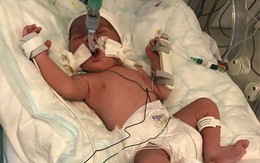 Bà bầu tử vong vì nỏ bắn xuyên bụng, thai nhi sống sót thần kỳ