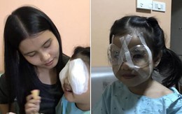 Hành động sai lầm của cha khi cho con ăn cơm khiến bé gái 4 tuổi phải phẫu thuật mắt