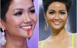 "Soi" Mai Phương Thuý, H’Hen Niê, Huyền My thay đổi “ngoạn mục” khi giã từ răng khểnh