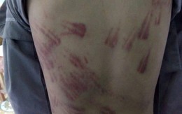 Thông tin bất ngờ vụ việc "bé trai mồ côi bị sư thầy đánh bầm tím"