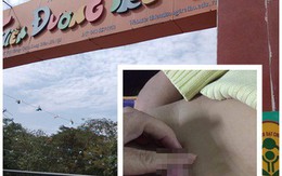 Bé trai 4 tuổi bị tổn thương vùng kín: Cô giáo muốn công an vào cuộc