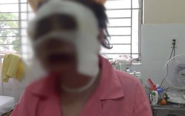 Công an huyện Củ Chi ráo riết truy bắt kẻ tạt axit cô gái sắp cưới