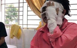Cô gái sắp cưới bị tạt axit hỏng 2 mắt ở Sài Gòn: 'Tôi đau đớn lắm, có thể đám cưới sẽ phải dời lại để lo chữa trị'